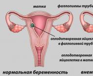 妊娠から月経まで: 兆候を認識する方法